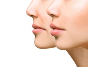 The Science Behind Facial Fillers