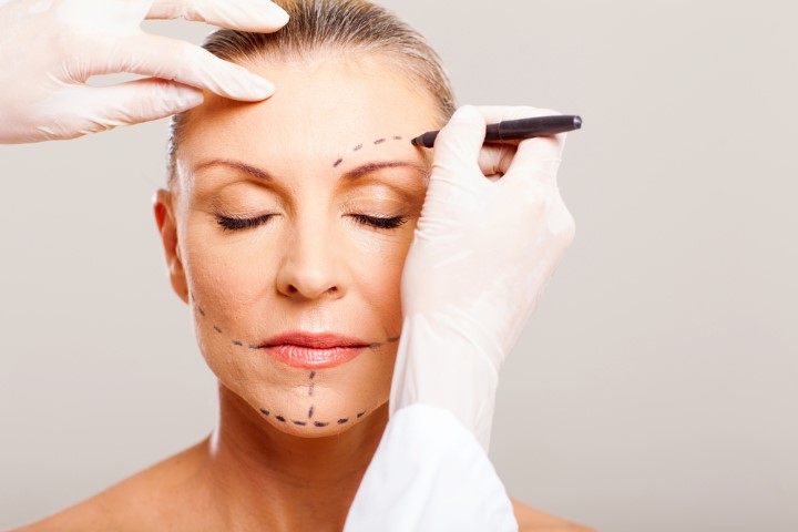 Recover from a facelift