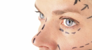 facial fillers, facial filler recovery, age reversal, minimally invasive cosmetic procedures, wrinkle treatments